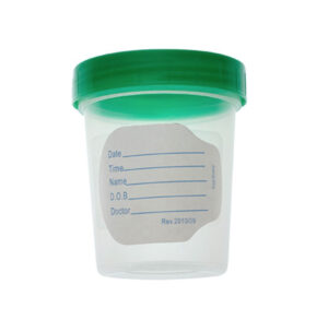 Clear plastic specimen container with green lid and measurement labels.
