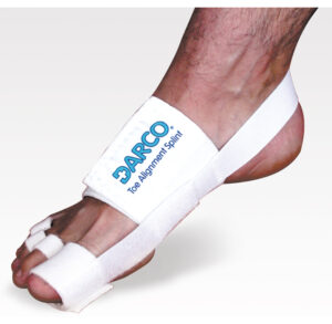 Foot with a white bunion corrector brace and toe separators.