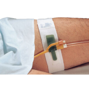 Close-up of an IV line inserted in a patient's arm secured with medical tape.